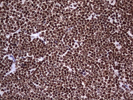 HNRNPL / hnRNP L Antibody (aa270-502, clone OTI9G7, Carrier-free)