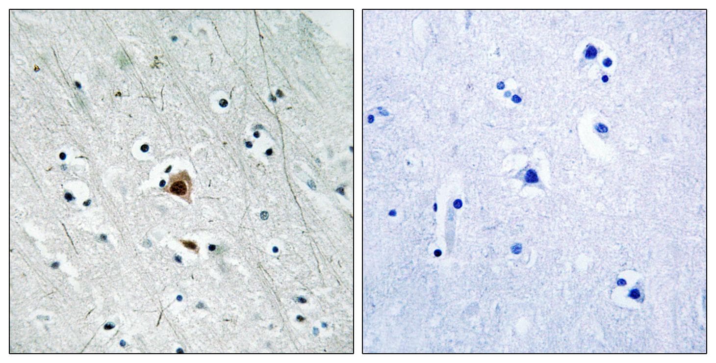 MAPKAPK2 / MAPKAP Kinase 2 Antibody (phospho-Ser272)