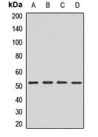 Delta-6 Desaturase / FADS2 Antibody