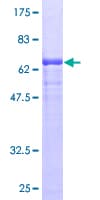 Human HSP90B1 / GP96 / GRP94 Protein (Recombinant GST)