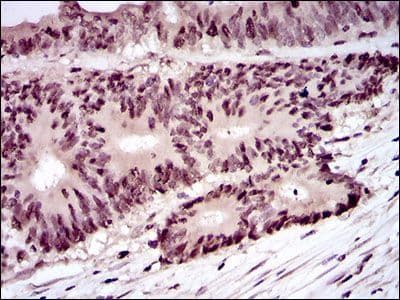 Monoclonal Mouse anti-Human PCNA Antibody (clone 7H4F8, Amino Acid: 53-196, IHC, WB)