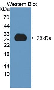 HDLBP / Vigilin Antibody (aa158-371)