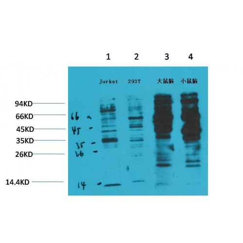 Phosphotyrosine Antibody (clone 2C1)