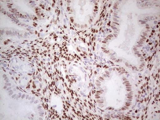 Monoclonal Mouse anti-Human PR / Progesterone Receptor Antibody (clone OTI4A11, aa1-298, IHC, WB)