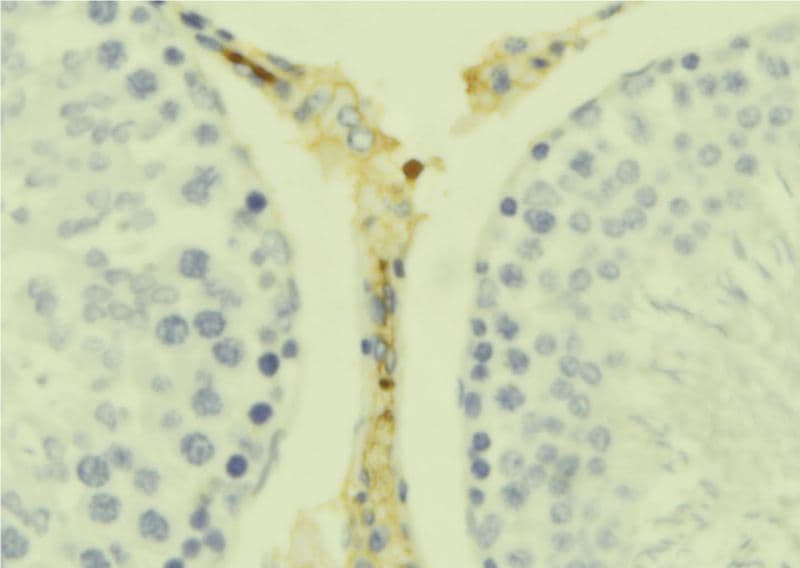 IL17B Antibody