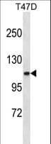 Polyclonal Rabbit anti-Human COL3A1 / Collagen III Antibody (aa1410-1438, WB)