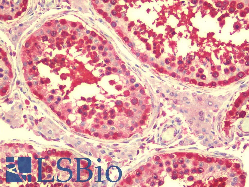 IHC-plus™ Polyclonal Rabbit anti-Human RAPGEF4 / EPAC2 Antibody (IHC, IF, WB)