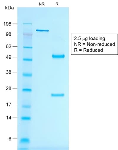 PathPlus™ Recombinant Monoclonal Mouse anti-Human MLANA / Melan-A Antibody (clone rMLANA/788, IHC)