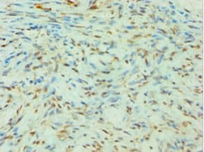 SLC4A2 / AE2 Antibody (aa95-245)