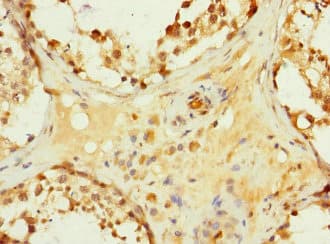 Polyclonal Rabbit anti-Human HHIP / HIP Antibody (IHC, WB)