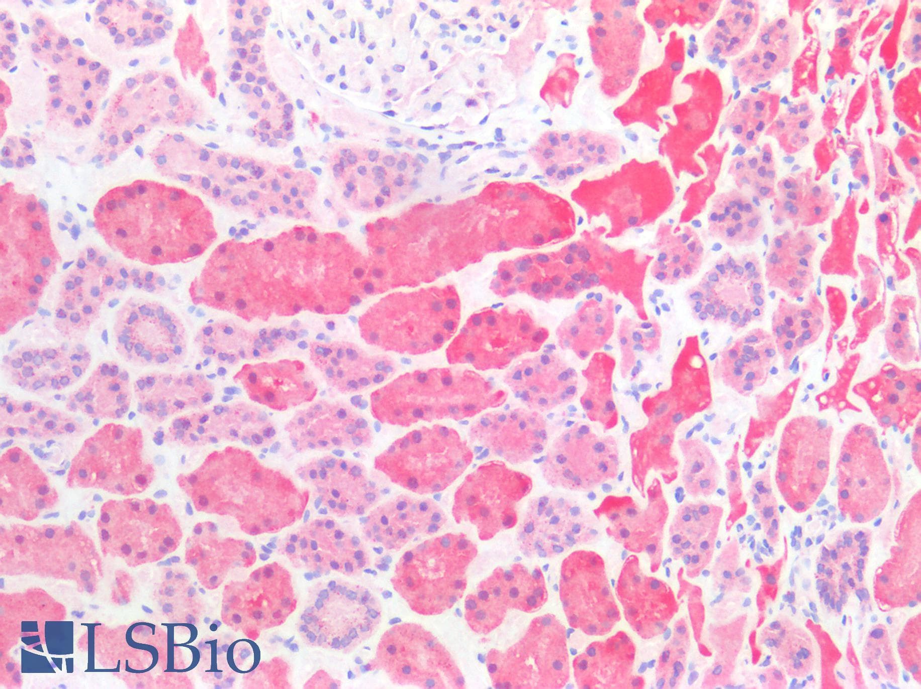 PathPlus™ CTSS / Cathepsin S Antibody
