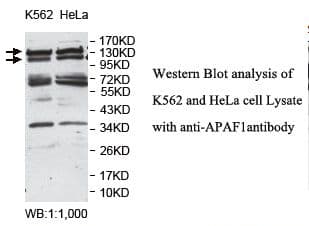 Polyclonal Rabbit anti-Human APAF1 / APAF-1 Antibody (N-Terminus, IHC, WB)