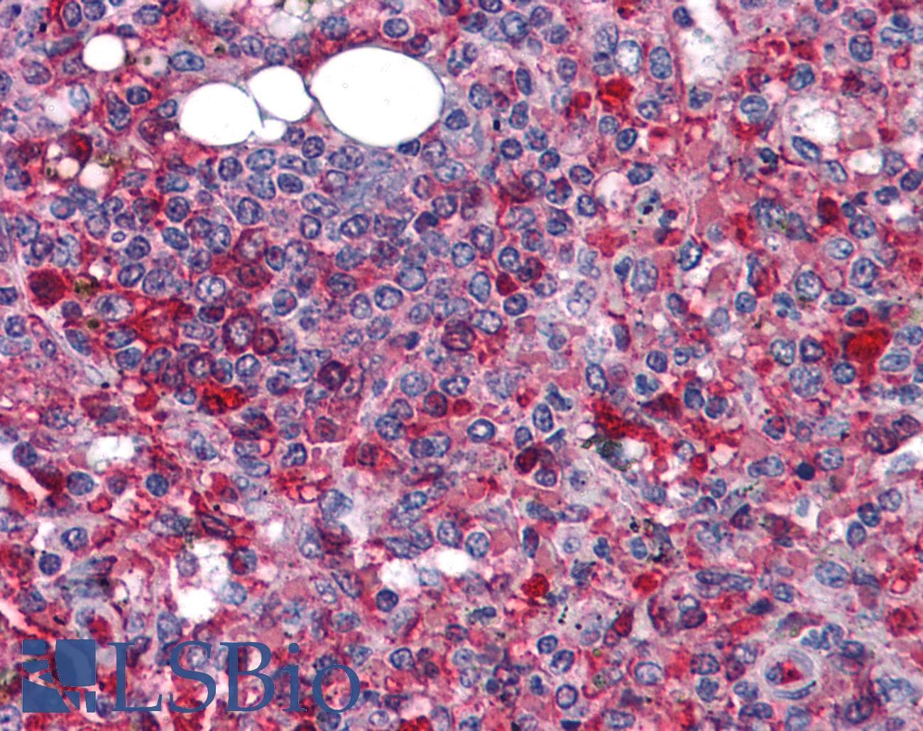 Polyclonal Rabbit anti-Human TMEM16B / ANO2 Antibody (IHC, IF, WB)