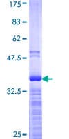 Human YBX1 / YB1 Protein (Recombinant GST, N-terminus)