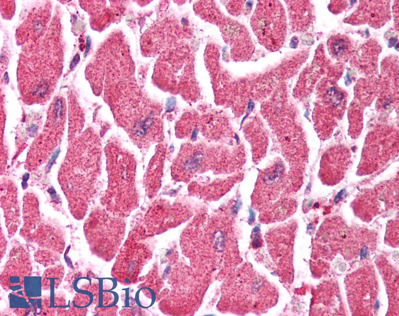 Polyclonal Rabbit anti-Human TRIM38 Antibody (C-Terminus, IHC, WB)