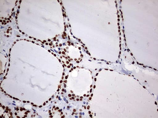 Monoclonal Mouse anti-Human HNRPM / HNRNPM Antibody (clone OTI1F6, aa1-261, IHC, WB)
