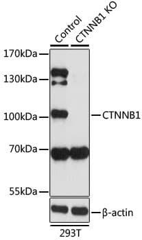 Polyclonal Rabbit anti-Human CTNNB1 / Beta Catenin Antibody (IHC, WB)