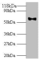 Polyclonal Rabbit anti-Human Papillomavirus 18 HPV L1 Capsid Antibody (WB)