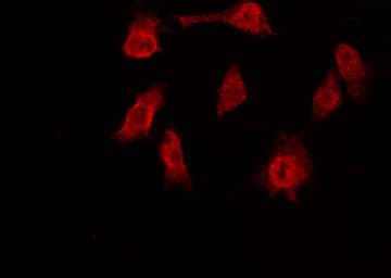 TRF1 / TERF1 Antibody
