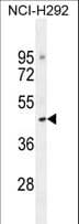 Polyclonal Rabbit anti-Human TJAP1 Antibody (aa144-171, IHC, WB)