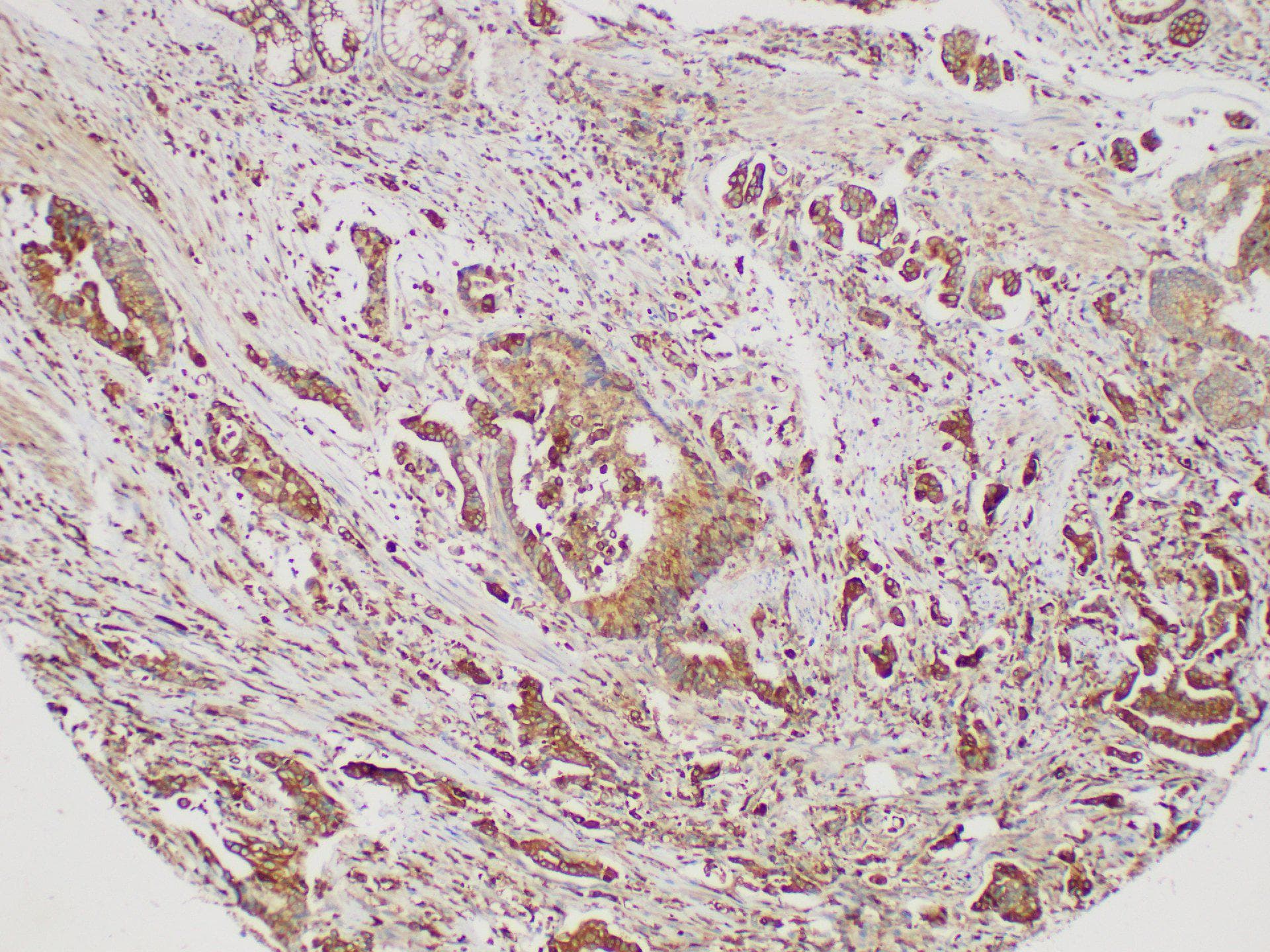 S100A4 / FSP1 Antibody