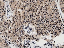BTN1A1 Antibody (clone OTI7B5)