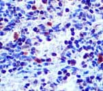 TCR Beta Antibody