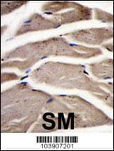 Polyclonal Rabbit anti-Human PFKM / PFK-1 Antibody (aa746-776, IHC, IF, WB)