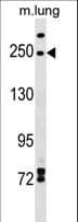 Polyclonal Rabbit anti-Human INF2 Antibody (aa589-616, WB)