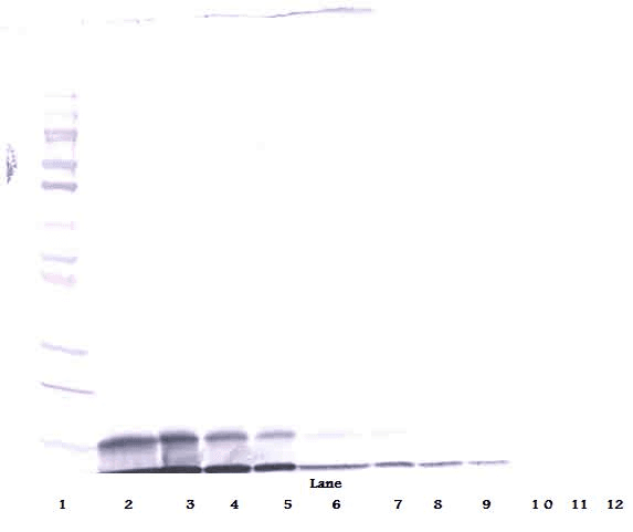 PathPlus™ IGF1 Antibody