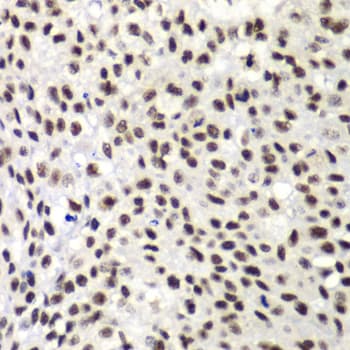NELFE / RD / RDBP Antibody