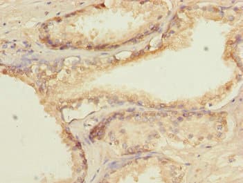 GTF2A2 / TFIIA Antibody