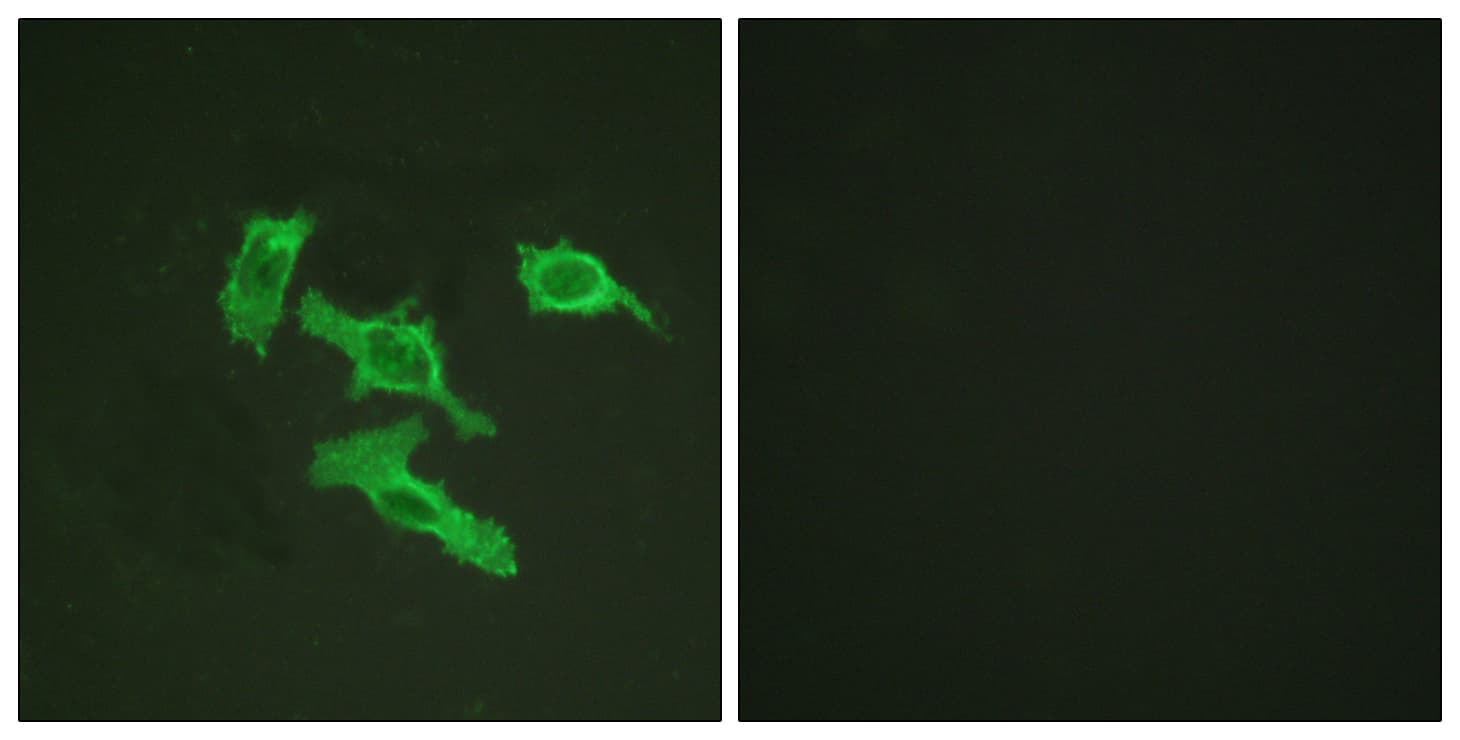 EGFR Antibody (aa986-1035)