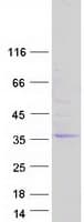 Human CITED2 Protein (Recombinant Myc-DDK (Flag))