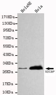 SDCBP / Syntenin Antibody