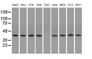 ACAT2 Antibody (clone OTI3C9)