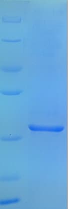 Human Complement C3 Protein (Recombinant His)
