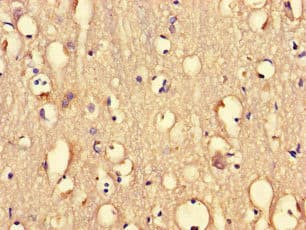 Polyclonal Rabbit anti-Human PRMT5 Antibody (IHC, IF)