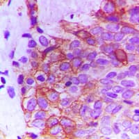 Polyclonal Rabbit anti-Human FGFR2 / FGF Receptor 2 Antibody (Internal, IHC, WB)