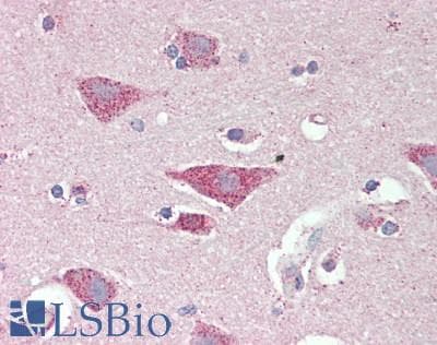 IHC-plus™ SLC8A3 / NCX3 Antibody