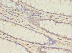 ATG16L1 / ATG16L Antibody (aa1-607)