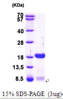 Human SUB1 Protein (Recombinant His)