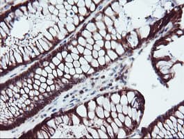 SERPINB1 Antibody (aa77-306, clone OTI2B4)