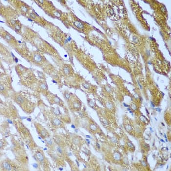 Polyclonal Rabbit anti-Human IMP-3 / IGF2BP3 Antibody (IHC, WB)