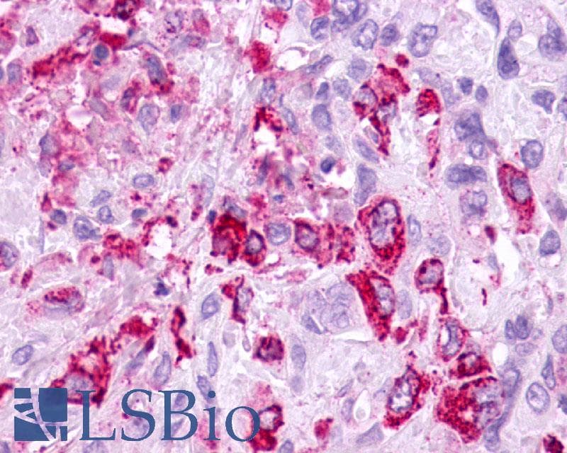 IHC-plus™ Polyclonal Rabbit anti-Human MC5R / MC5 Receptor Antibody (N-Terminus, IHC)