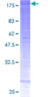 Human SMARCC2 Protein (Recombinant GST)