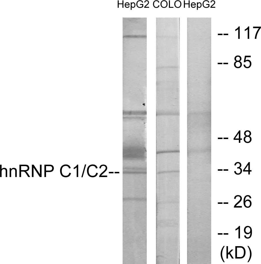 IHC-plus™ HNRNPC / HNRNP C Antibody (aa241-290)