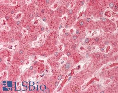 Polyclonal Rabbit anti-Human JAG2 / Jagged-2 Antibody (aa714-981, IHC, WB)