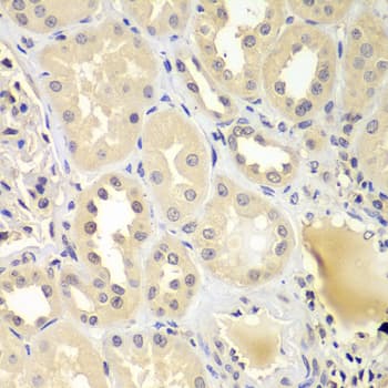 UBE2Z / USE1 Antibody