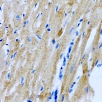 Polyclonal Rabbit anti-Human PDE4DIP / MMGL Antibody (IHC, WB)